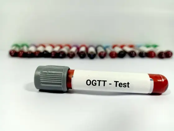 Test obciążenia glukozą - Wyniki i interpretacja (ciąża i nie)